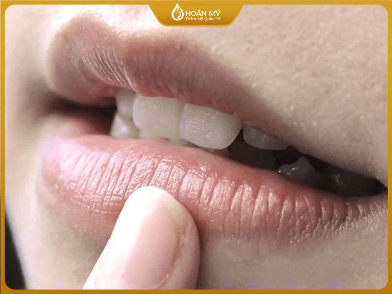 Người có môi thâm tối màu nên phun môi pha lê