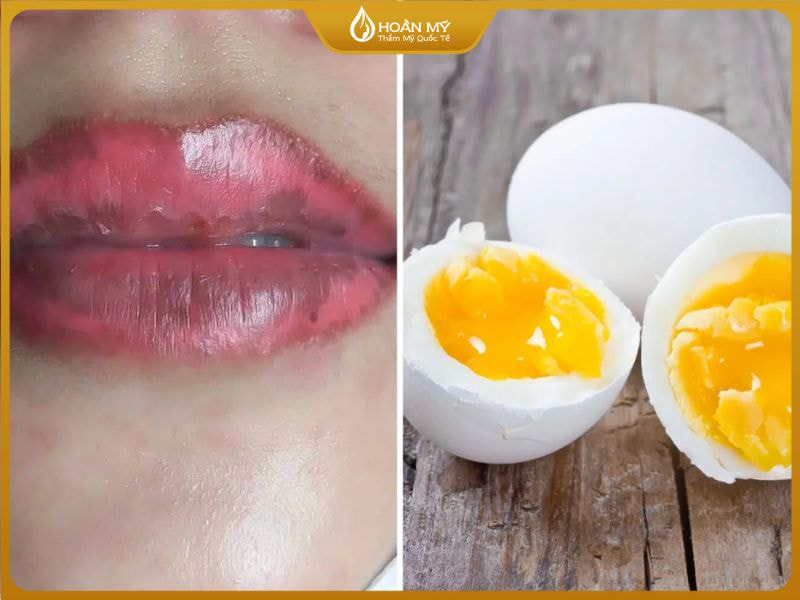 Màu môi sẽ phai rất nhanh nếu và sai tông nếu ăn trứng quá sớm