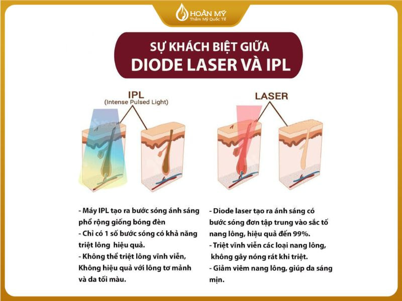 So sánh sự khác biệt giữa 2 công nghệ Diode Laser và IPL