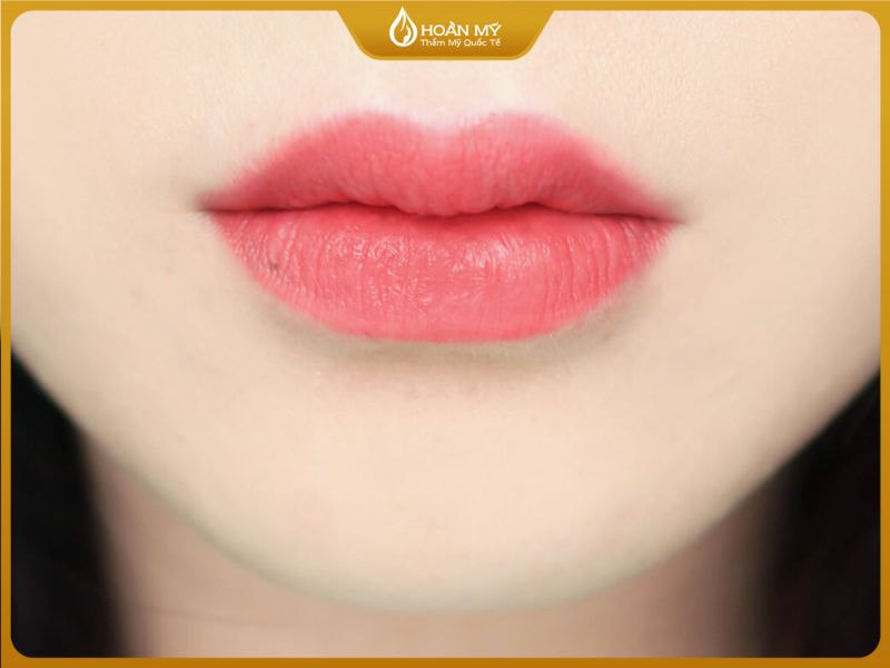 Đường viền môi là điểm dễ nhận thấy nhất để đánh giá chất lượng phun