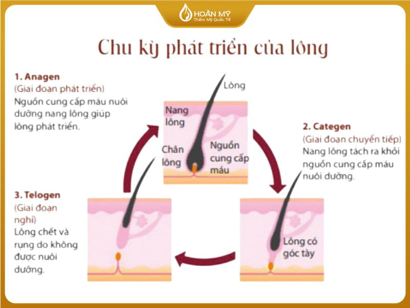 Sơ đồ chu kỳ phát triển của lông bao gồm các giai đoạn Anagen, Catagen và Telogen giúp giải thích tại sao cần triệt lông nhiều lần