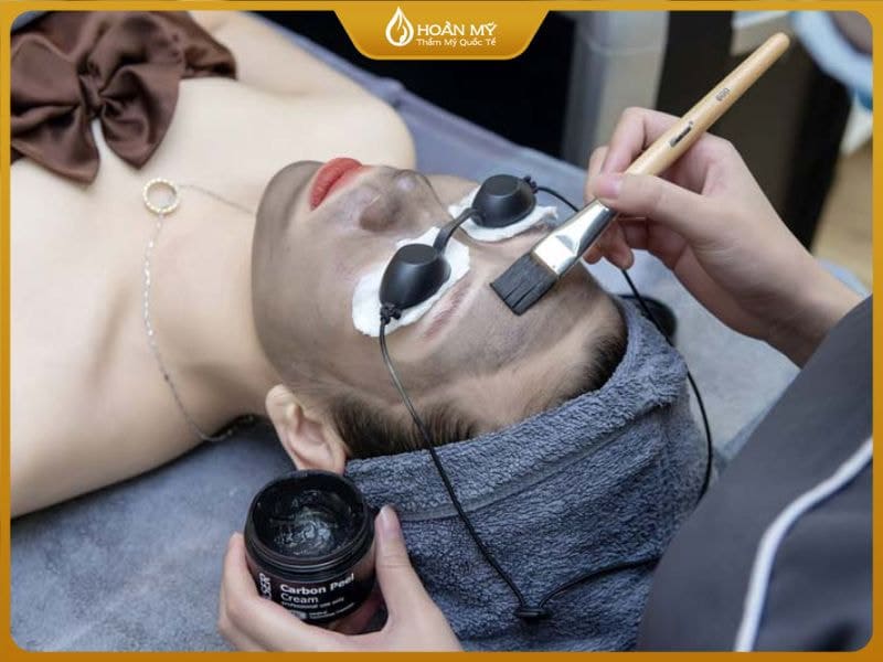 Phương pháp Laser Carbon giúp thanh lọc da và se khít lỗ chân lông.