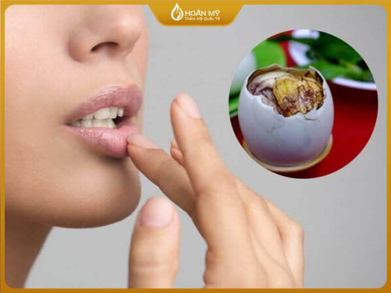 Chuyên gia khuyến cáo nên kiêng hoàn toàn các loại trứng ít nhất 3–4 tuần