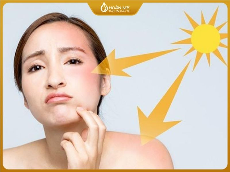 Luôn sử dụng kem chống nắng, dưỡng ẩm kèm theo viên uống chống nắng để bảo vệ làn da khỏi tia UV