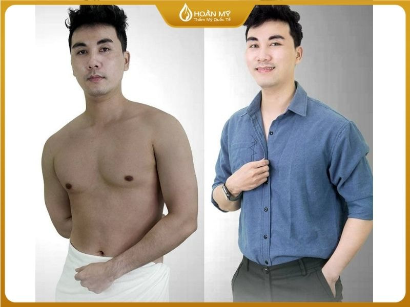 Trắng khoẻ và nam tính không trắng quá khiến mất vẻ nam tính