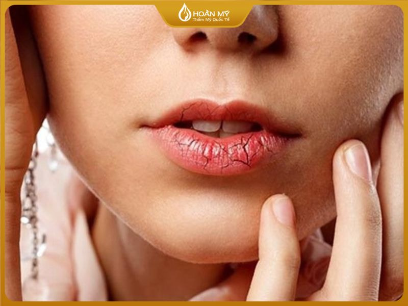 Dặm lại môi nhanh chóng rất dễ làm môi bị tổn thương