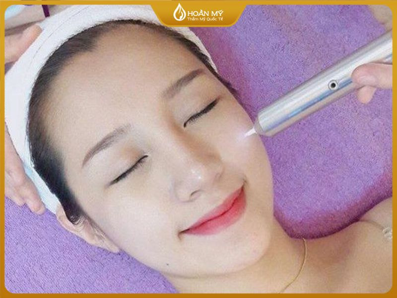 Cách trị mụn dưới da bằng công nghệ Plasma