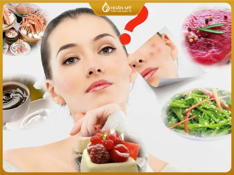 Điều chỉnh chế độ sinh hoạt và thói quen sống là một phương pháp ngăn ngừa mụn hiệu quả