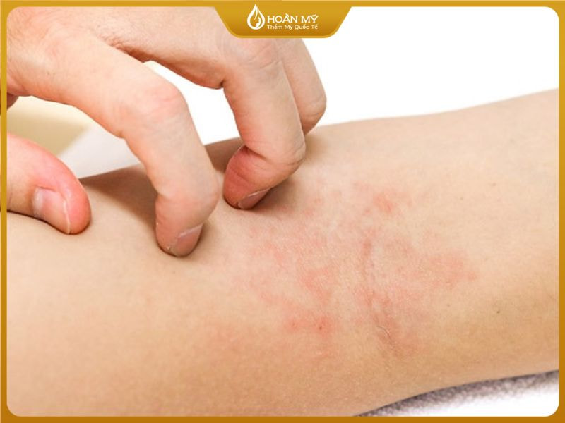 Cảnh báo rủi ro khi triệt lông tại nhà hoặc cơ sở kém uy tín