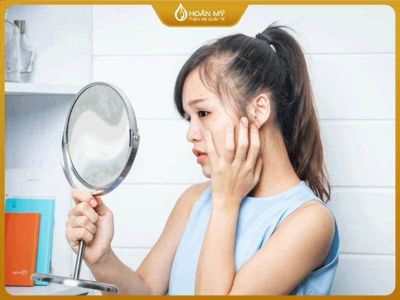 Mụn cám hình thành do nhiều yếu tố từ bên ngoài đến bên trong