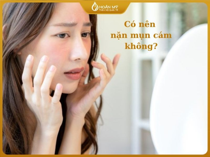 Việc nặn mụn cám thường không được khuyến khích 