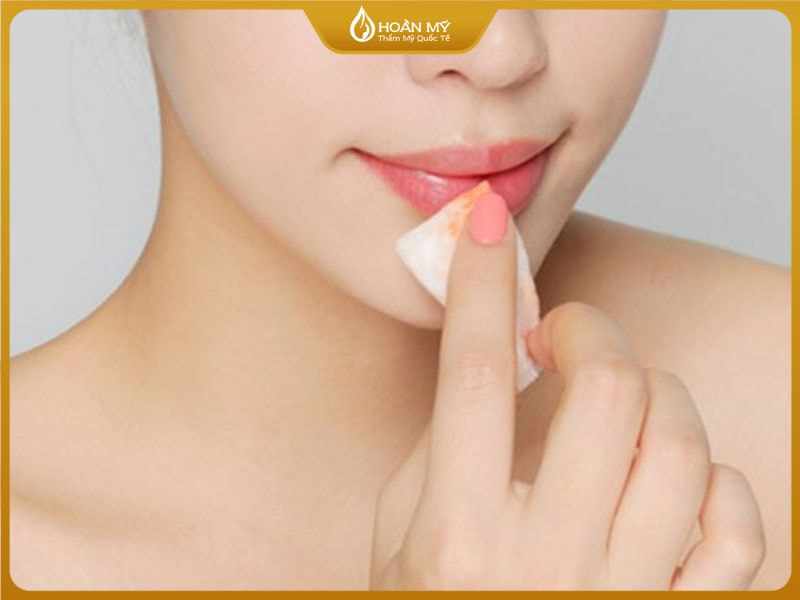 Dùng nước muối sinh lý để làm sạch môi