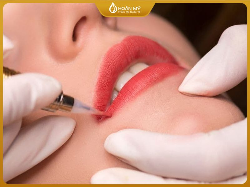 Đôi môi căng mọng hồng hào nhờ kỹ thuật phun môi chuẩn y khoa