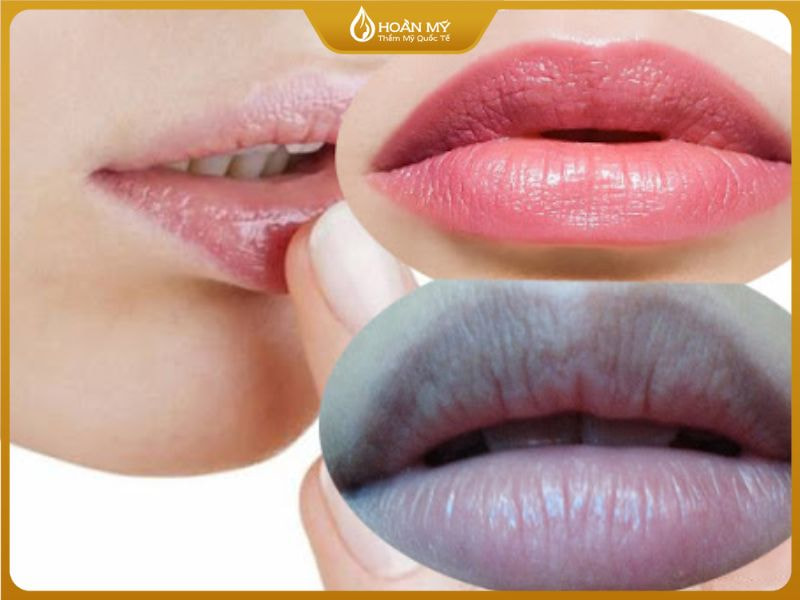 Những ai nên phun môi pha lê