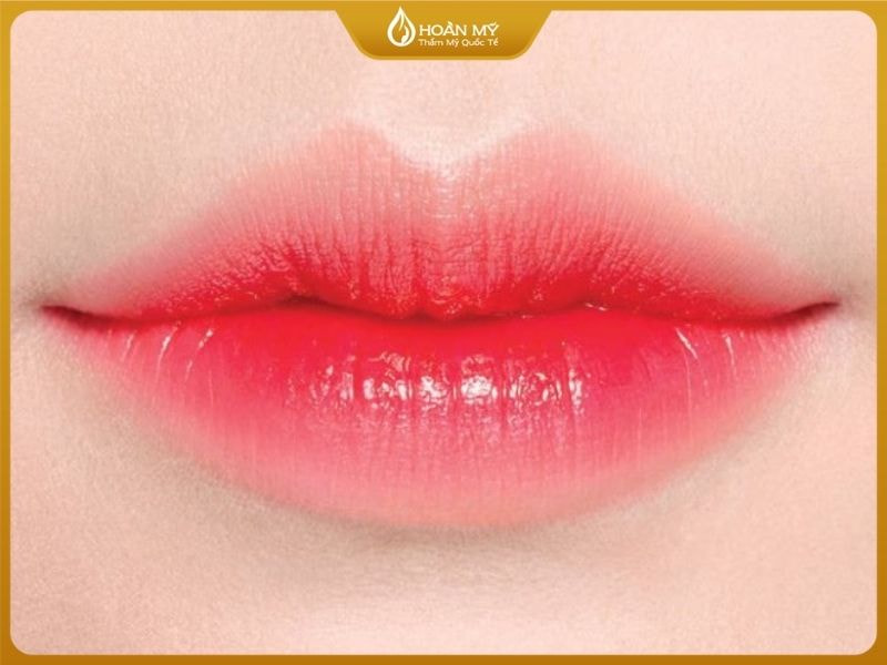 Cấy môi sinh học là gì?