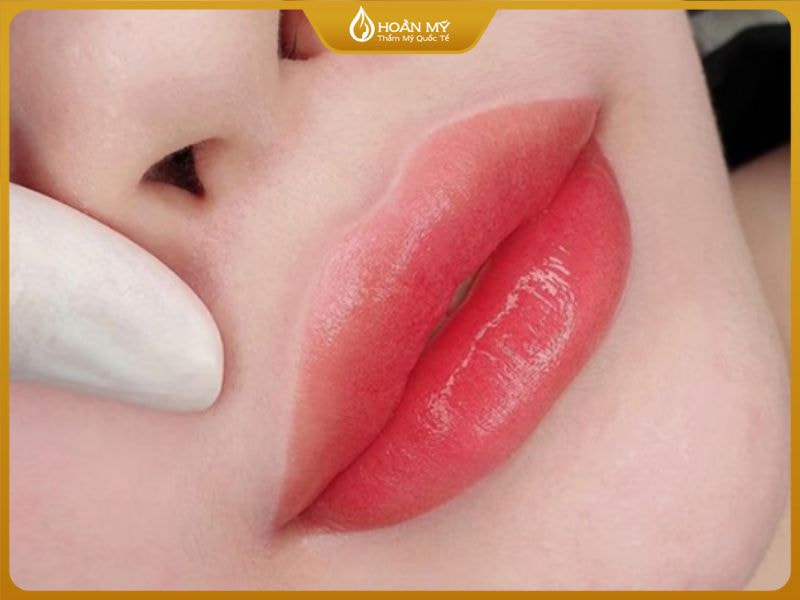 Cấy môi sinh học giá bao nhiêu? Chi phí cấy môi ảnh hưởng bởi các yếu tố: công nghệ, kỹ thuật viên, tinh chất và cơ sở vật chất