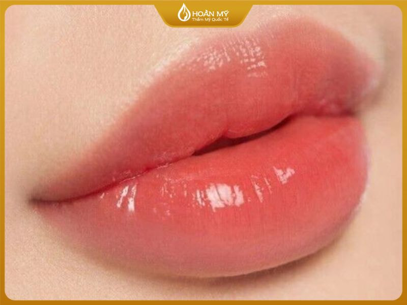 Thẩm Mỹ Quốc Tế Hoàn Mỹ - với quy trình chuẩn y khoa, đội ngũ kỹ thuật viên dày dặn kinh nghiệm