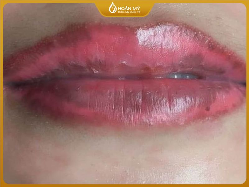 Không nên dặm môi quá sớm khi môi chưa bình phục