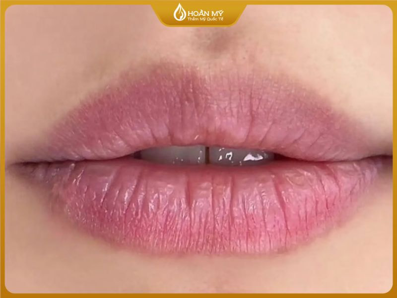 Một số người có thể gặp tình trạng môi chưa lên màu