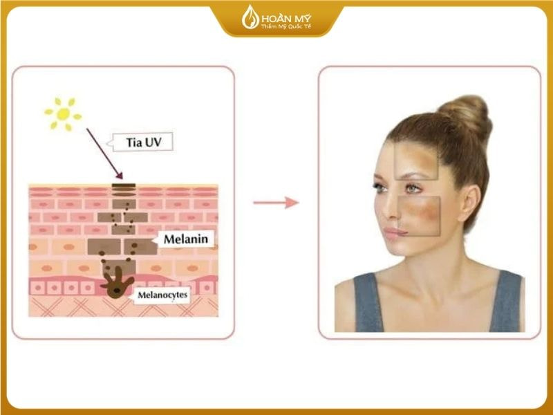 Tắm Trắng Phi Thuyền Có Bị Đen Lại Không? Giải Đáp Từ Chuyên Gia