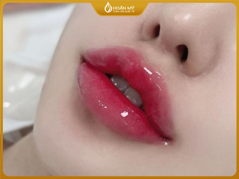 Phun Môi Phủ Collagen Là Gì? Giải Pháp Cho Đôi Môi Hồng Tự Nhiên