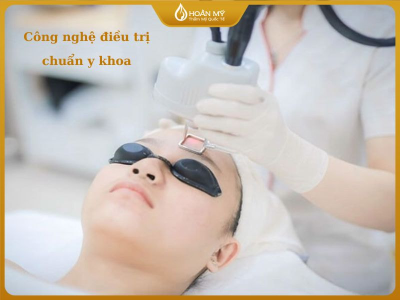 Công nghệ điều trị chuẩn y khoa tại Thẩm Mỹ Viện Hoàn Mỹ - địa chỉ trị mụn uy tín tphcm