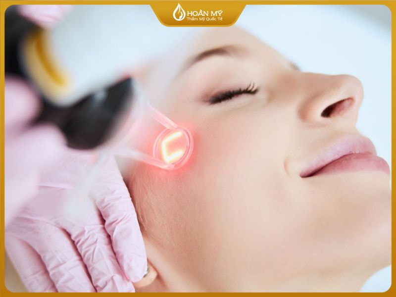 Công nghệ hiện đại Laser hỗ trợ điều trị mụn và làm giảm các vết thâm sẹo, tái tạo làn da