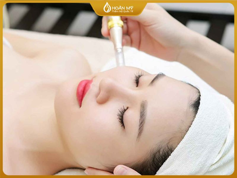 Điều trị mụn bằng công nghệ Phi Kim giúp tái tạo làn da