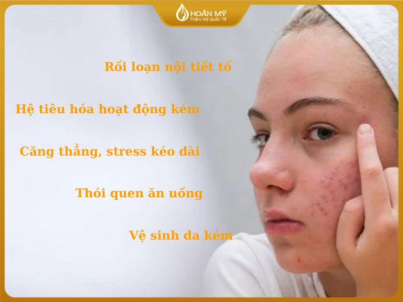 Mụn 2 bên thái dương do đâu? Từ những vấn đề bên trong cơ thể đến thói quen sinh hoạt hàng ngày