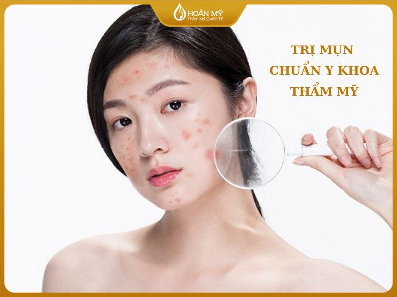 Phương pháp điều trị bằng y khoa sẽ giúp điều trị mụn 2 bên thái dương hiệu quả
