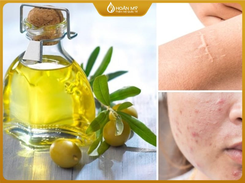 Mù u hỗ trợ làm mờ thâm, sẹo sau mụn, phục hồi làn da khỏe mạnh.