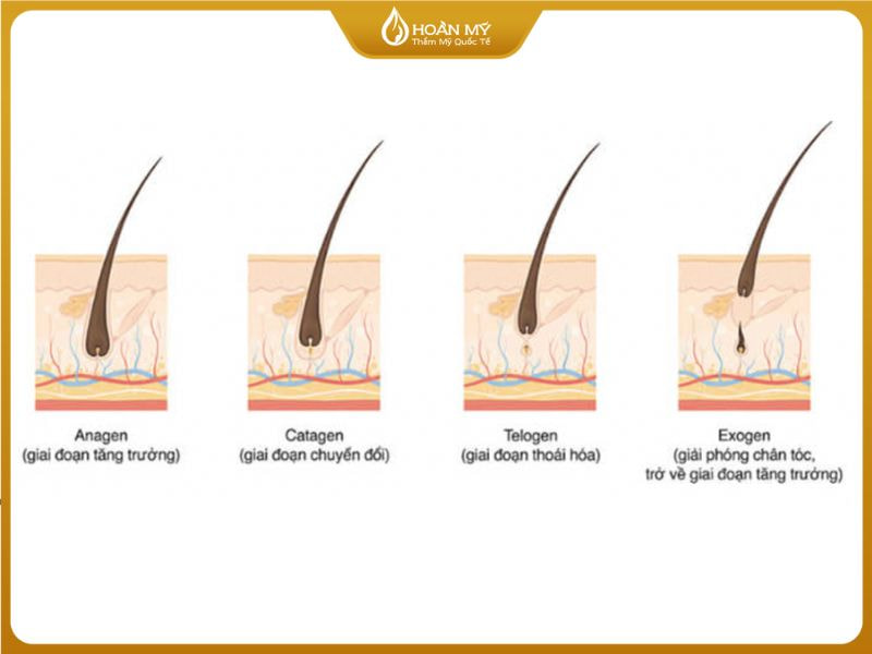 Chu kỳ phát triển của tóc Anagen là thời điểm lý tưởng nhất trong liệu trình triệt lông