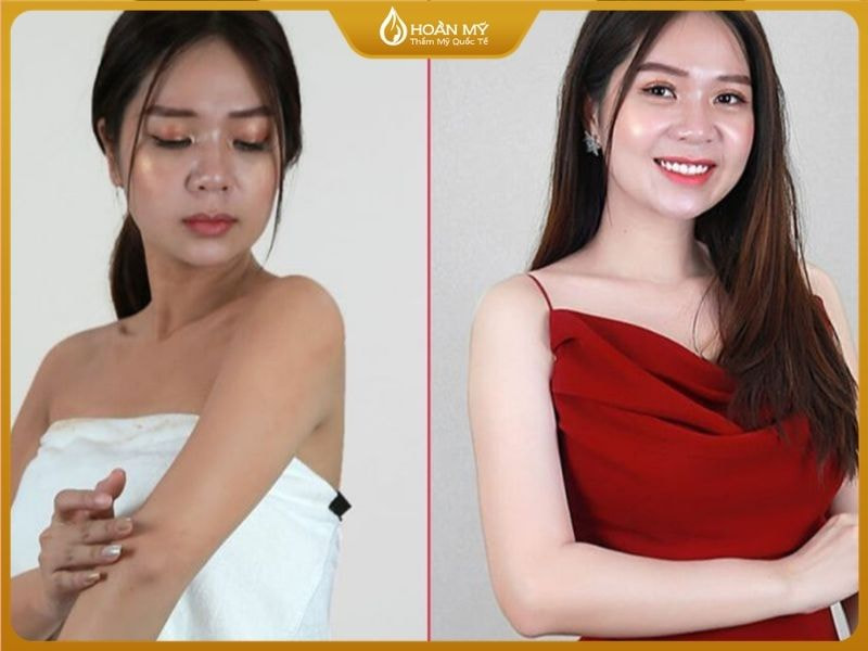 Khách hàng trải nghiệm dịch vụ sau khi thực hiện buổi tắm trắng đầu tiên