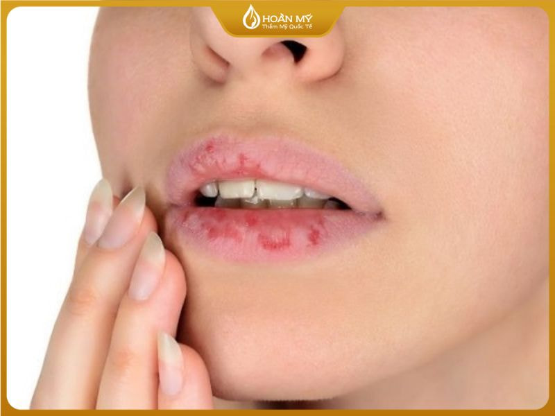 Dấu Hiệu Cho Thấy Phun Môi Không Lên Màu