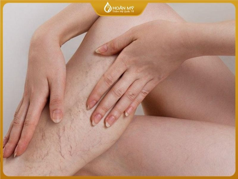 da bị bào mòn trở nen yếu ớt sau khi lột tẩy