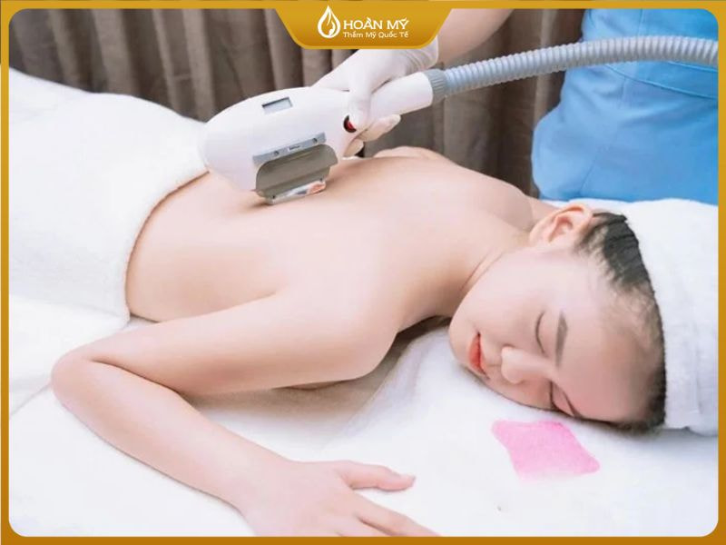 Lựa chọn địa điểm triệt lông lưng uy tín là bước đầu vô cùng quan trọng