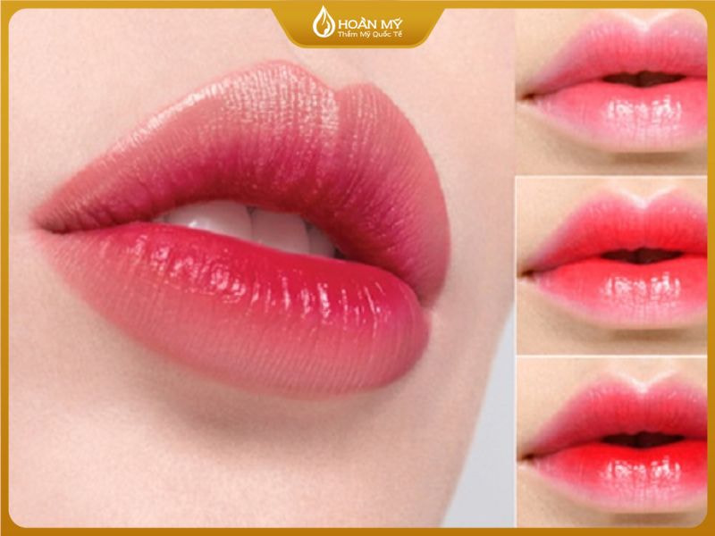 Phun môi collagen là gì bạn đã biết chưa?