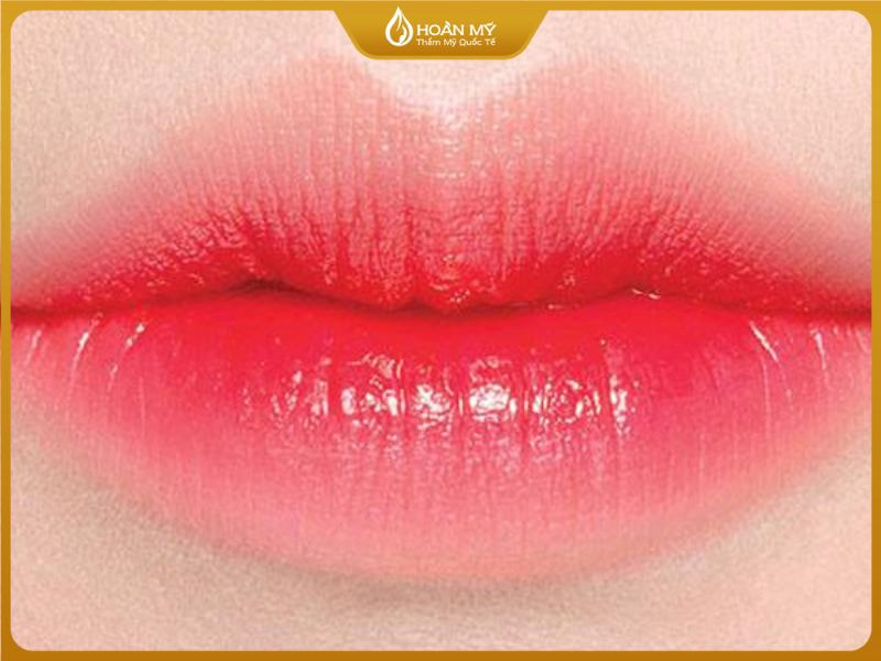 Thời gian lên màu chuẩn của phun môi pha lê và collagen thường từ 3–7 ngày tùy cơ địa.
