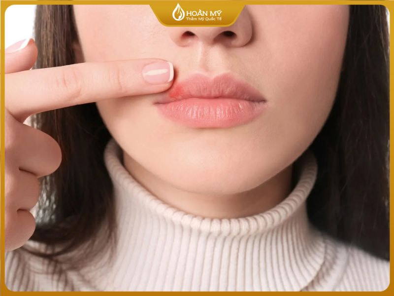 Thắc mắc thường gặp của khách hàng về việc dặm lại môi