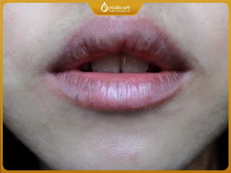 Dấu Hiệu Nhận Biết Xăm Môi Không Lên Màu