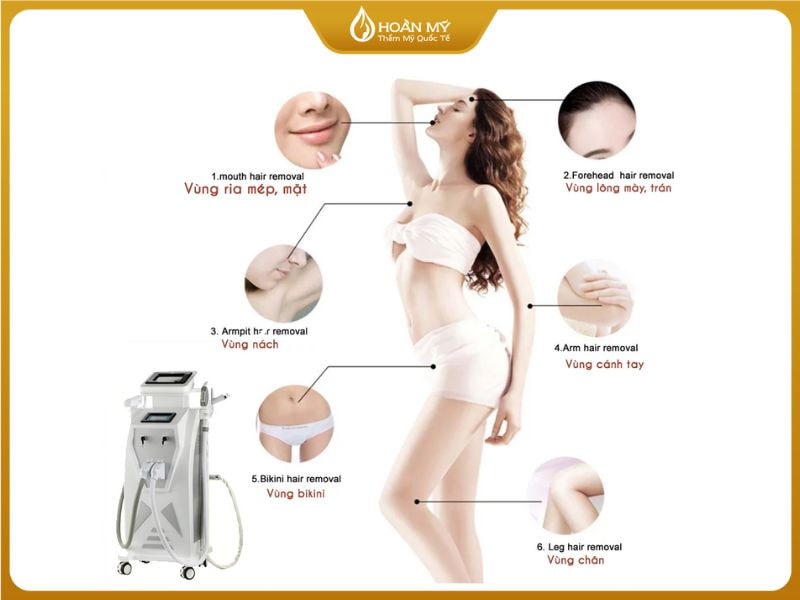 Bảng giá triệt lông vĩnh viễn 2026: Chi phí chi tiết và kinh nghiệm tối ưu ngân sách