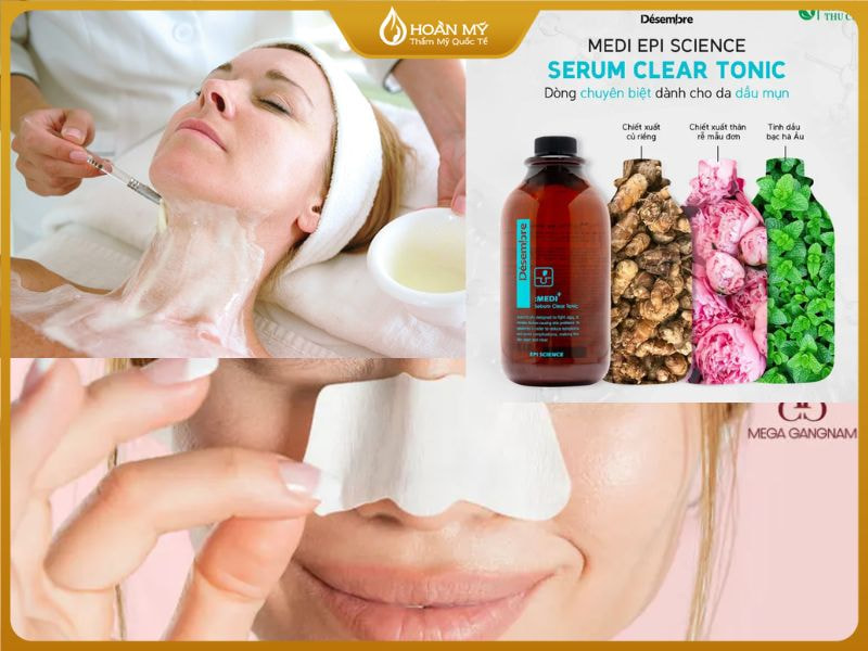 cách ủ mụn đầu đen phổ biến với sản phẩm đặc trị