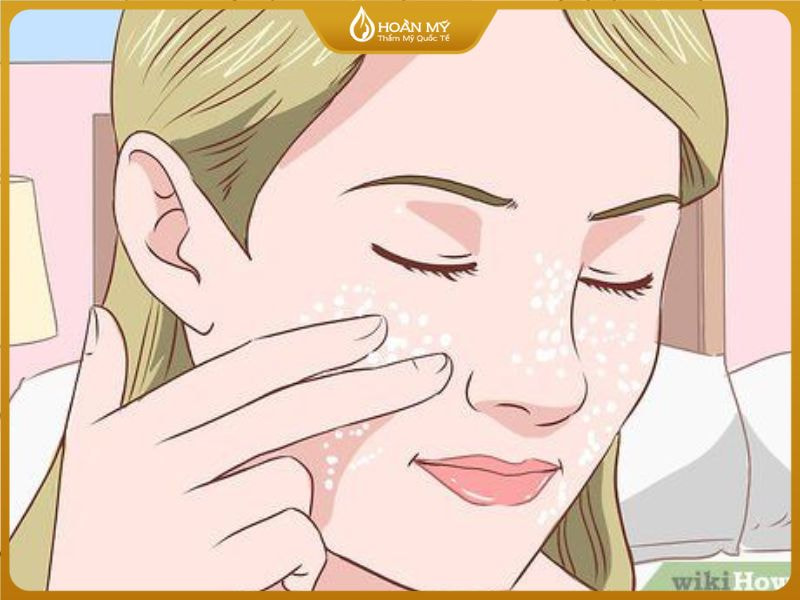 chăm sóc da giúp trị mụn ẩn ở má tại nhà gồm tẩy tế bào chết, dưỡng ẩm và chống nắng