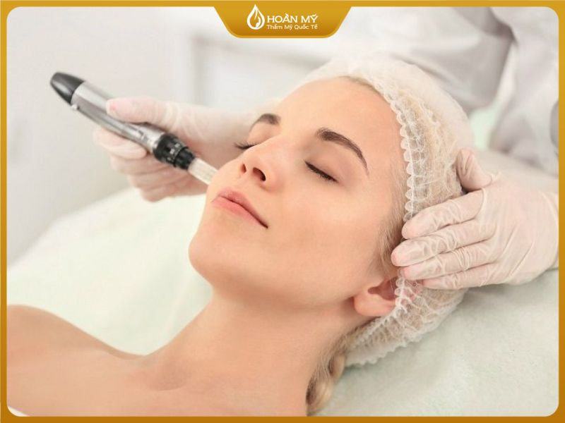điều trị mụn ẩn dưới da bằng phi kim hoặc laser