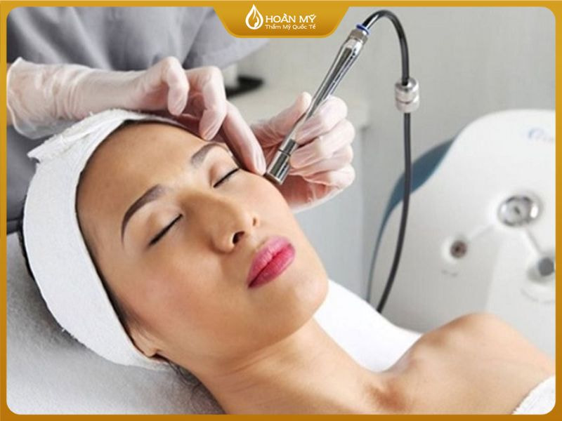 công nghệ laser Pico hoặc Toning giúp điều trị nám râu tận sâu lớp trung bì