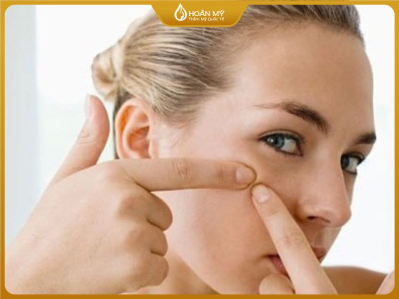 mụn ẩn có nên nặn không và mụn ẩn nên dùng gì