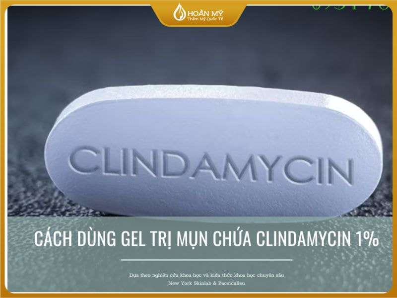 mụn viêm không nhân bôi gì khi sưng to có nên dùng Clindamycin